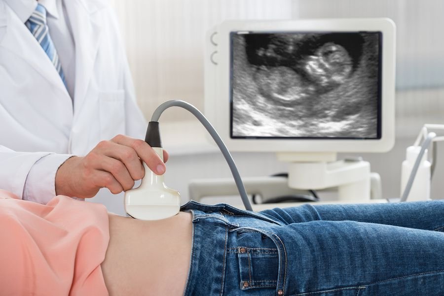 ULTRASOUND